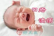 简单实用的小儿口腔溃疡炎症（口疮）的外治方法