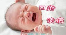 简单实用的小儿口腔溃疡炎症（口疮）的外治方法