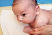 药浴治疗婴幼儿痱子湿疹