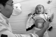 热敷药贴治疗小儿慢性腹泻