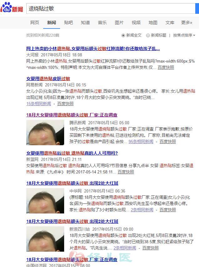 退烧贴过敏.jpg
