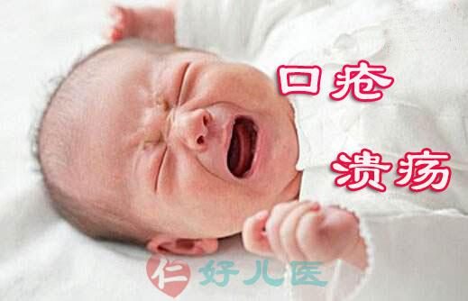 小儿口疮溃疡.jpg